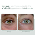 Load image into Gallery viewer, Plated EYE Serum
