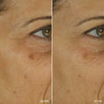 Load image into Gallery viewer, Aramore NAD+ Cell Energizing Treatment
