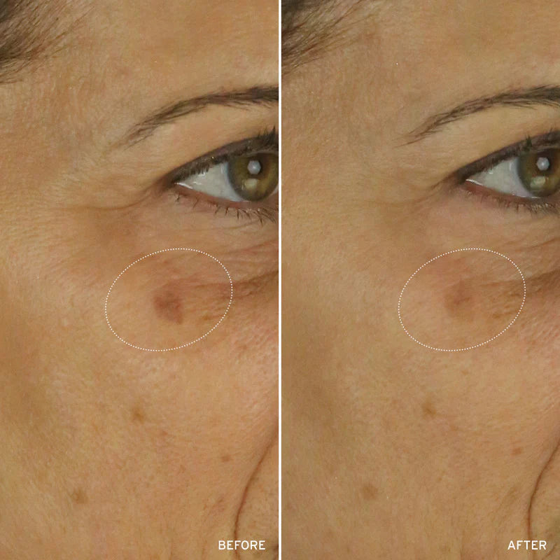 Aramore NAD+ Cell Energizing Treatment