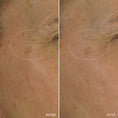 Load image into Gallery viewer, Aramore NAD+ Cell Energizing Treatment
