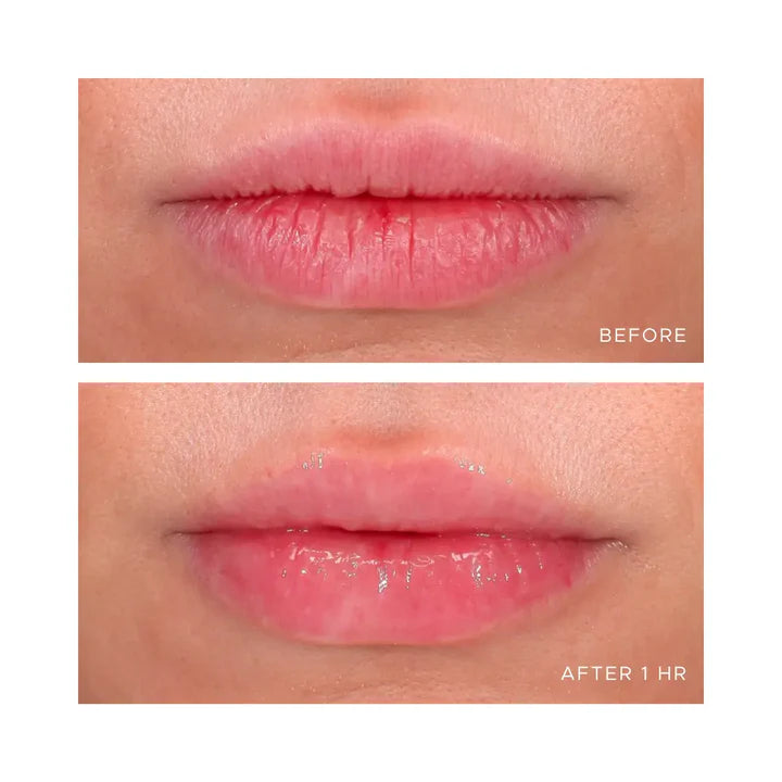 Anfisa ÂN-GLOSS Ceramide Lip Treatment