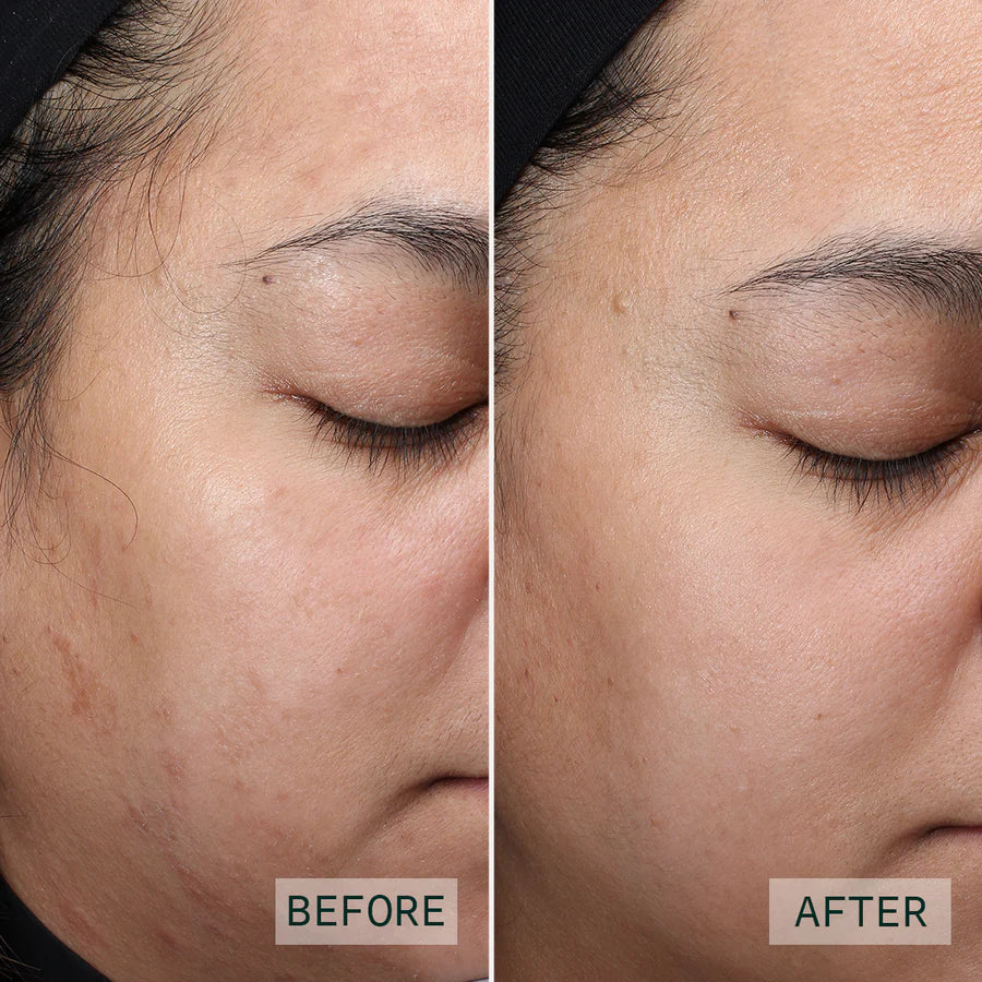 Aramore NAD+ Cell Restoration Cream